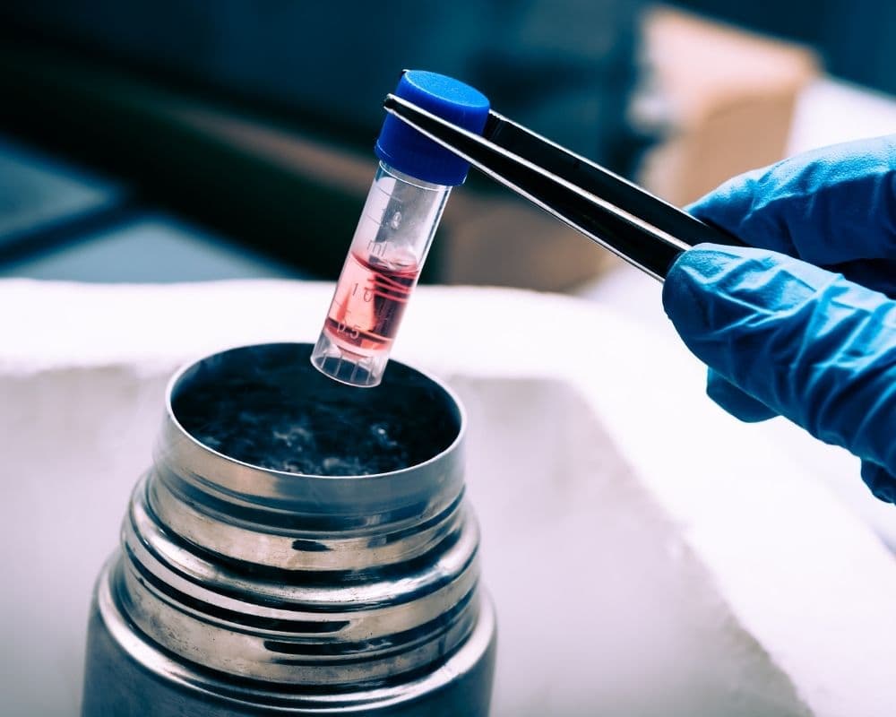 A blue-gloved hand using forceps to lower a capped sample vial into a frosted cryogenic container, part of stem cell processing and storage.