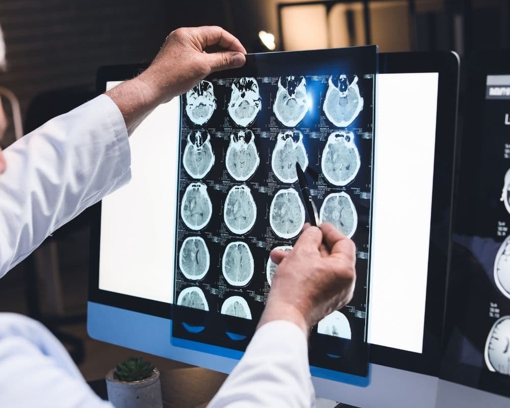 A clinician in a white coat reviewing a grid of axial brain CT scans on a monitor, pointing to an area of injury.