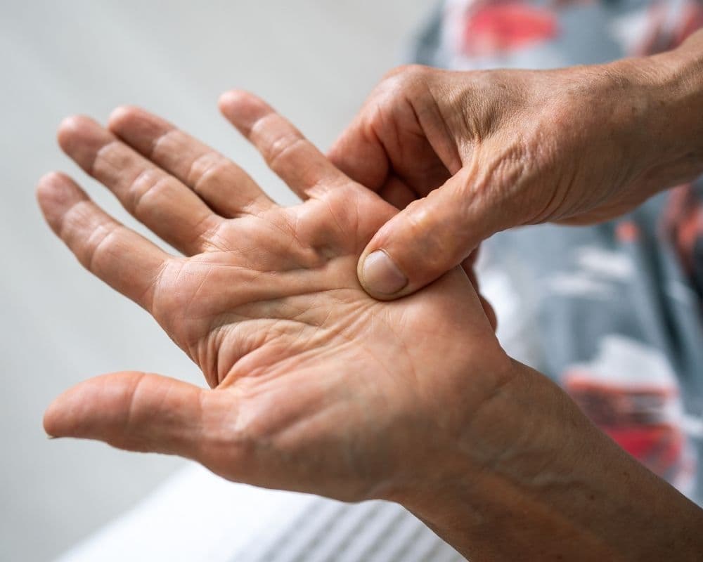 Close-up of an older person's hands examining the palm and fingers, illustrating a condition affecting the hand's connective tissue.