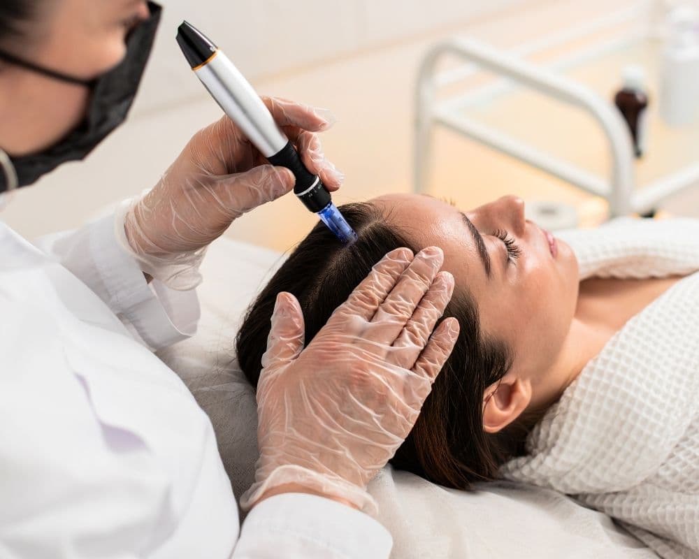 A masked, gloved clinician performing a regenerative microneedling treatment along a relaxed patient's hairline.
